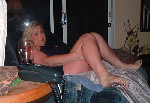 33_glamourshot_sunburn